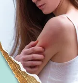 Seasonal TipsSeasonal triggers may contribute to your AD flares.2 Learn more about different lifestyle changes and management techniques that can potentially mediate symptoms as the weather changes.